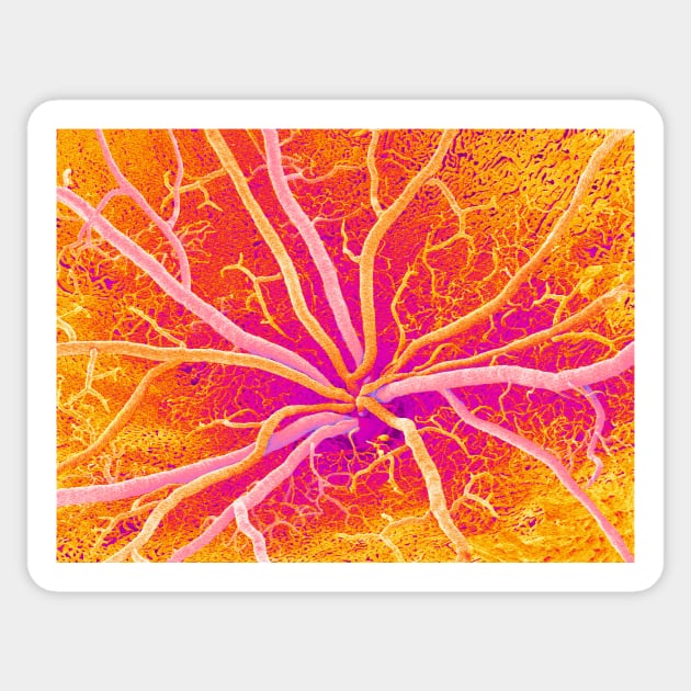 Retina blood vessels, SEM (P424/0265) Sticker by SciencePhoto